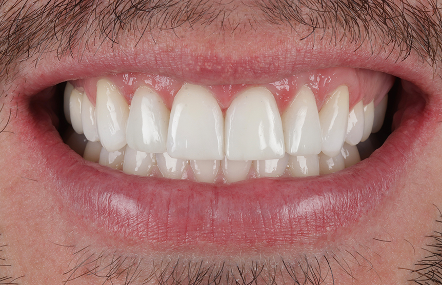 After - Meliora Dental