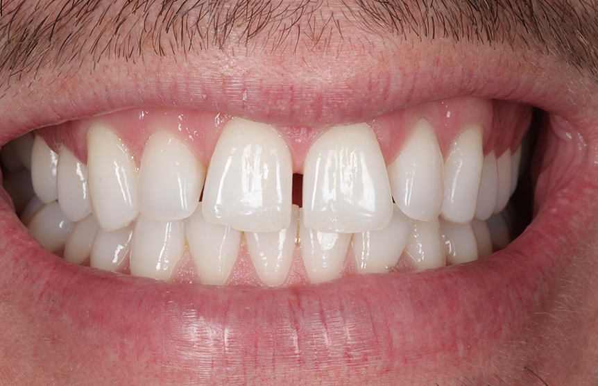 Before - Meliora Dental