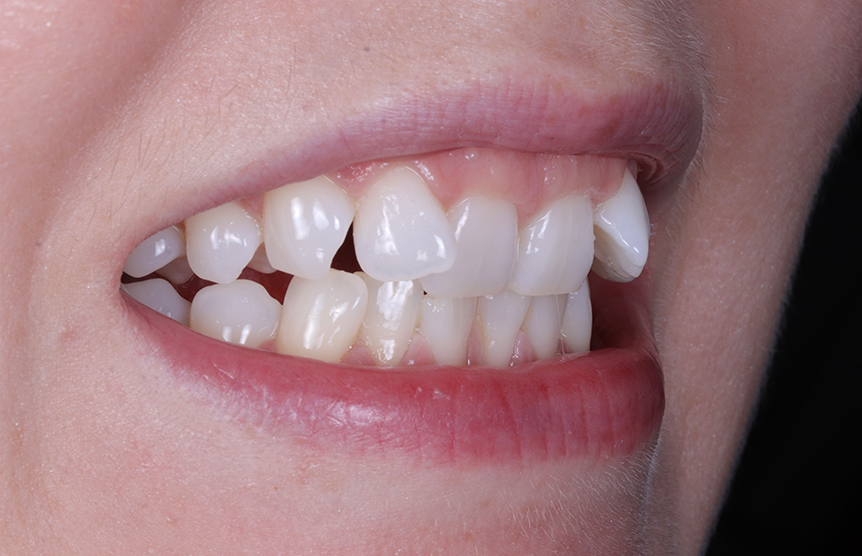 Before - Meliora Dental