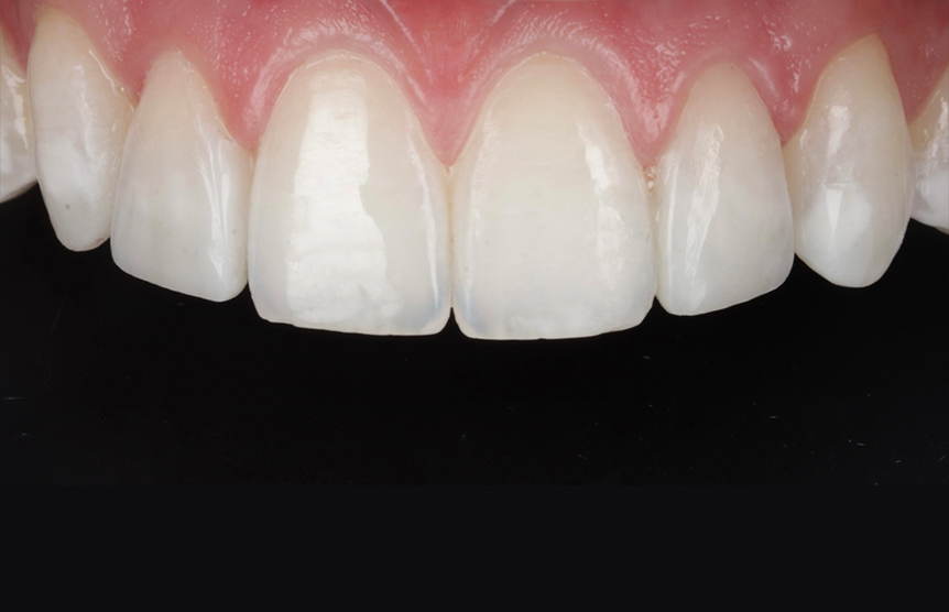 After - Meliora Dental