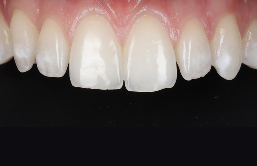 Before - Meliora Dental