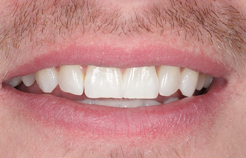 Before - Meliora Dental