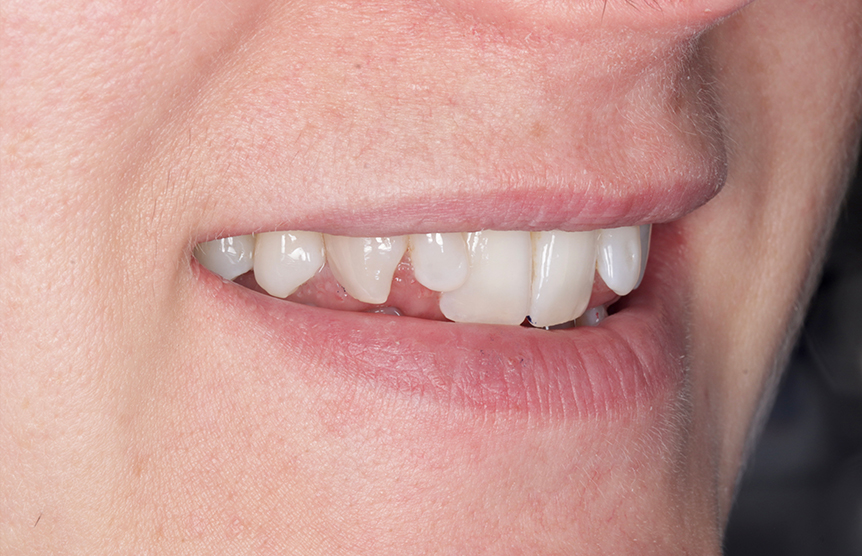 Before - Meliora Dental