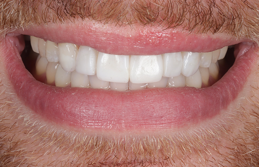 After - Meliora Dental