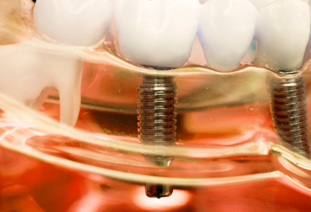 blog - Meliora Dental