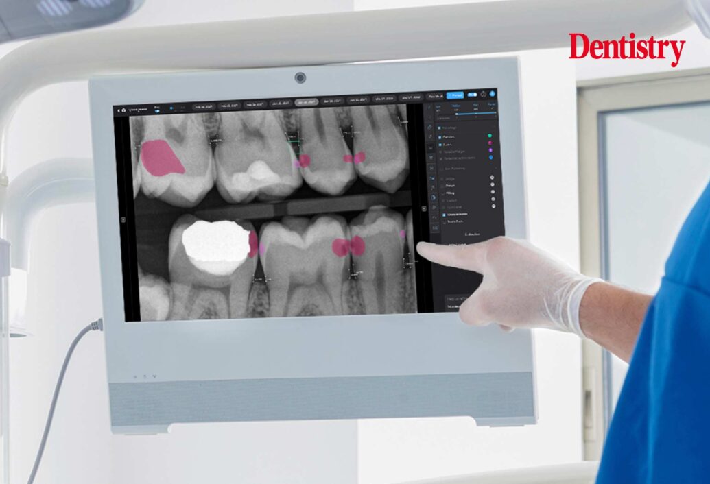 Close up of a Pearl May machine, used to take digital X-rays. This is an AI X-ray machine.