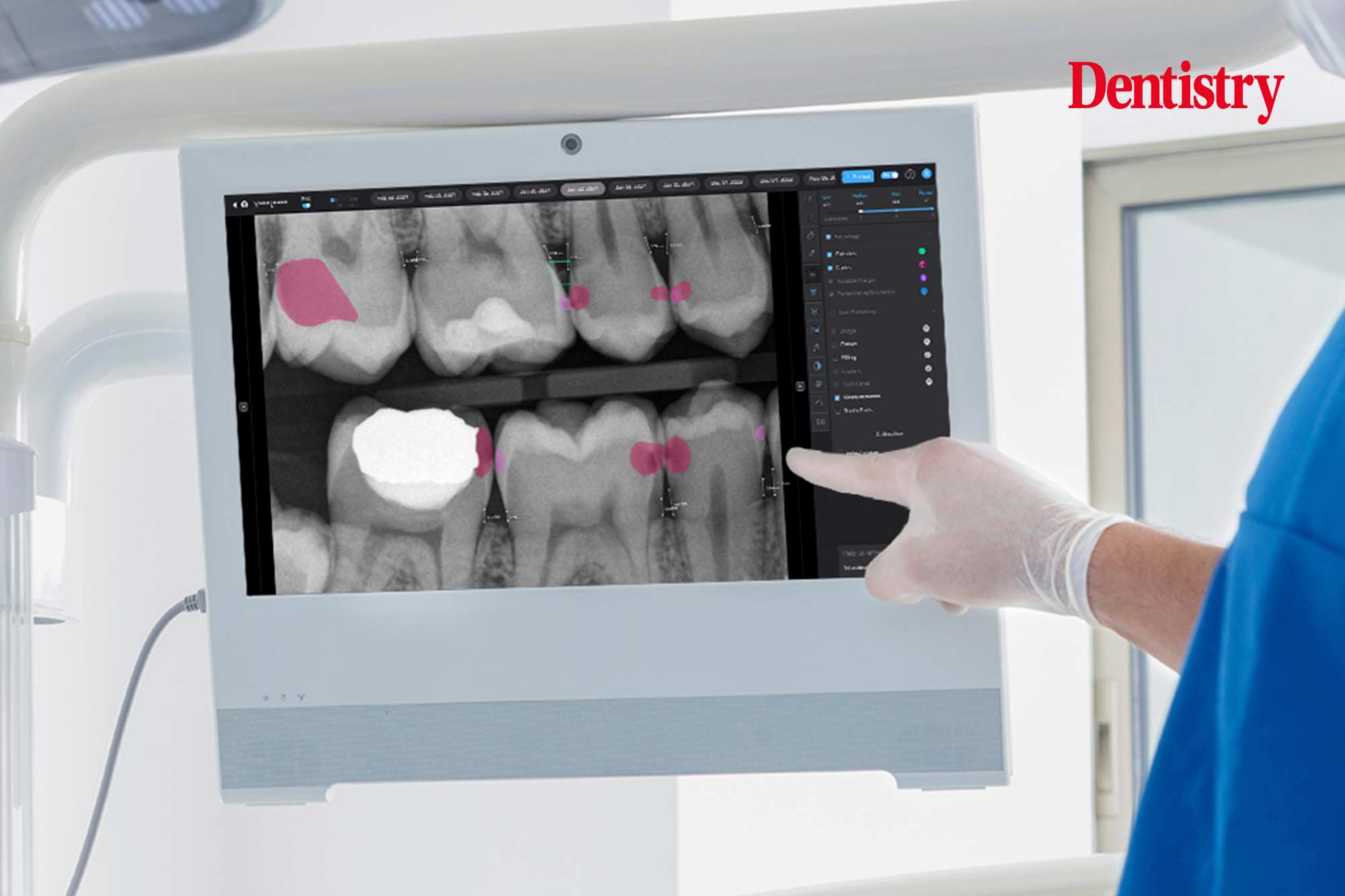 Close up of a Pearl May machine, used to take digital X-rays. This is an AI X-ray machine. 