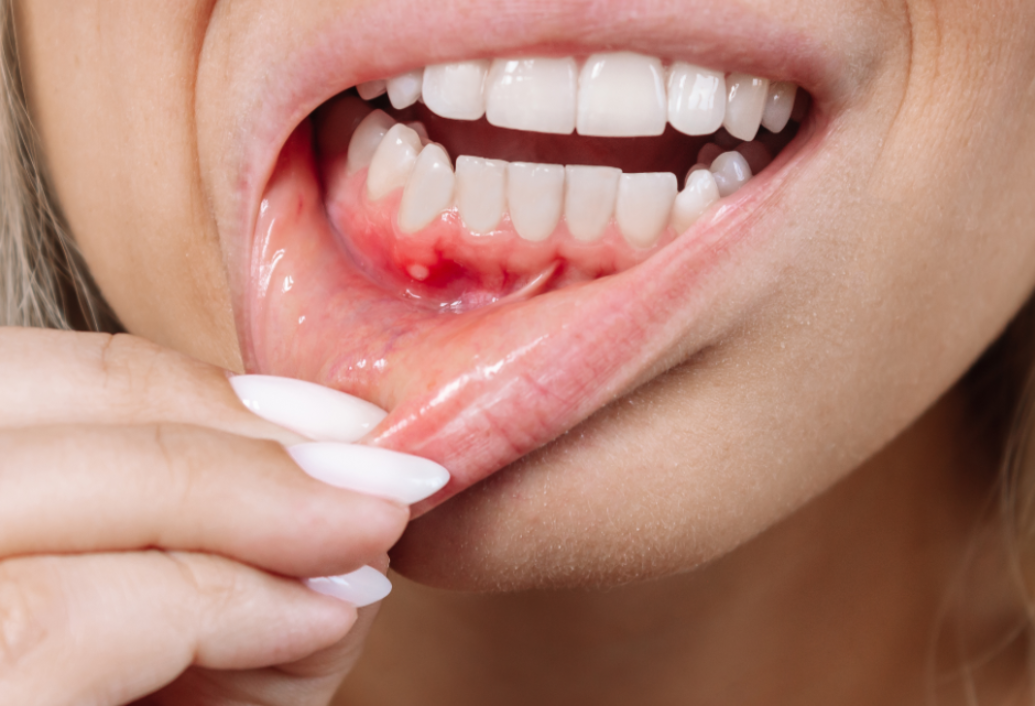 blog - Meliora Dental