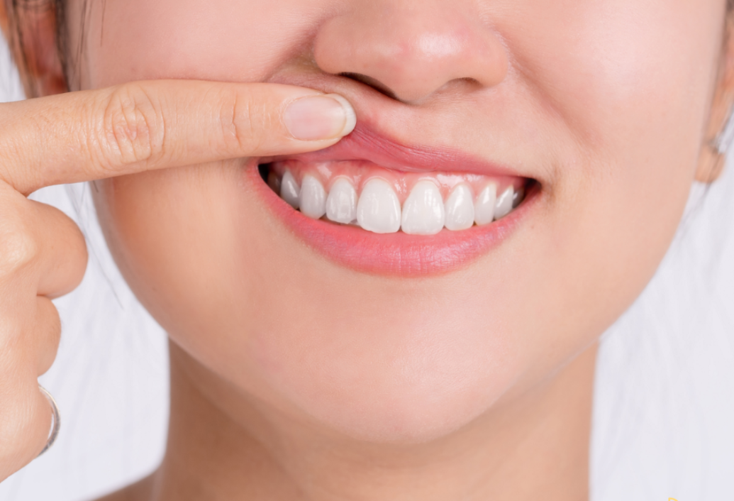 blog - Meliora Dental