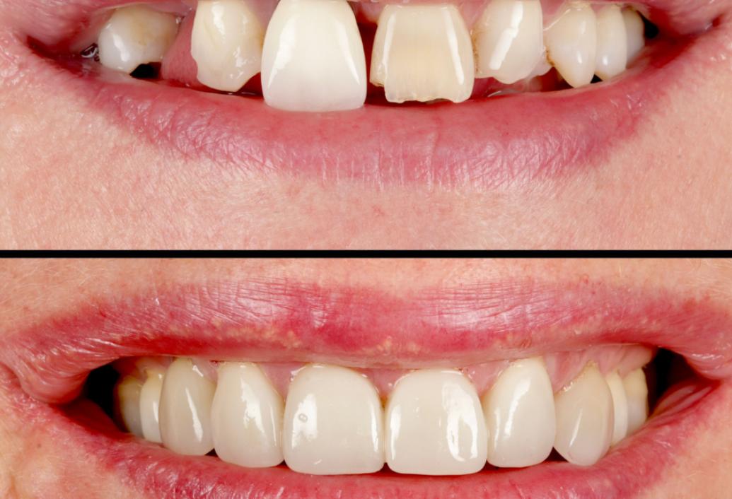 blog - Meliora Dental