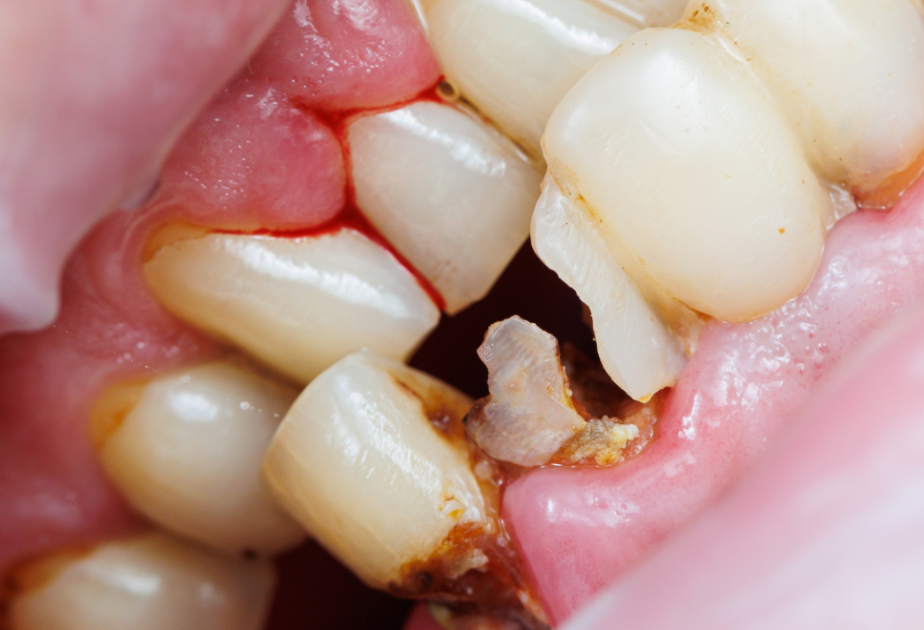 blog - Meliora Dental